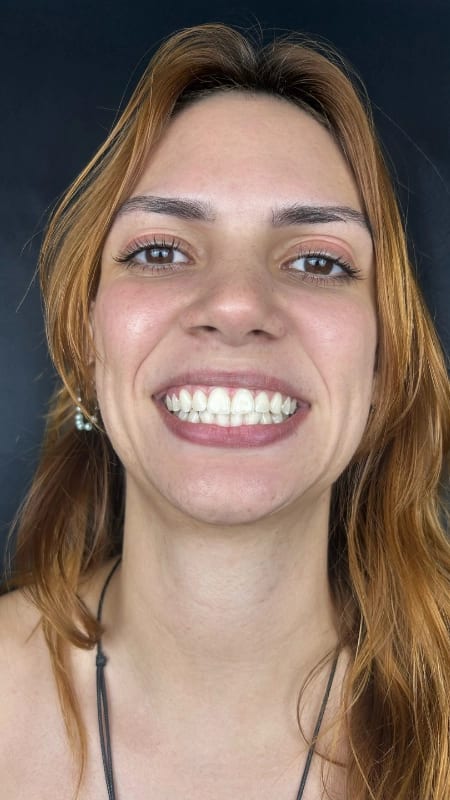 Depois